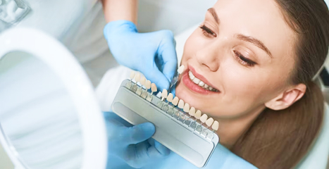 Dental Veneers