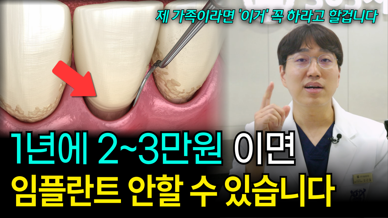 스케일링 말고 치과가면 이거 꼭 해달라고 하세요!! 나중에 임플란트 안합니다