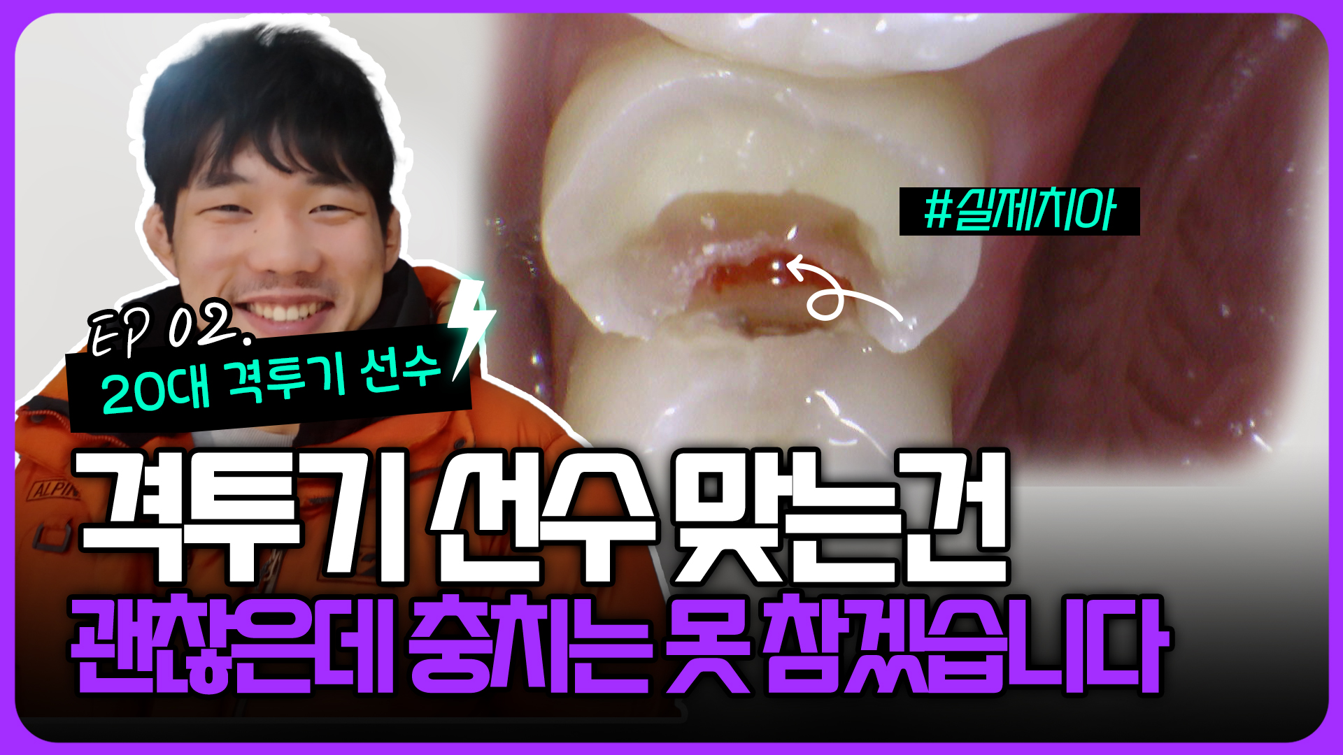 맞는 건 괜찮은데… 충치는 못 참겠습니다｜20대 격투기 선수 치과 방문기