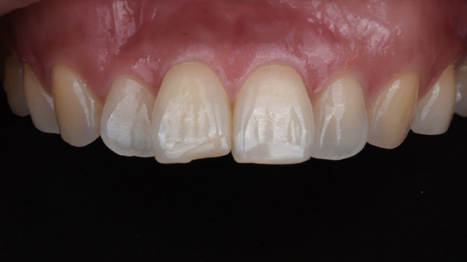 color photo