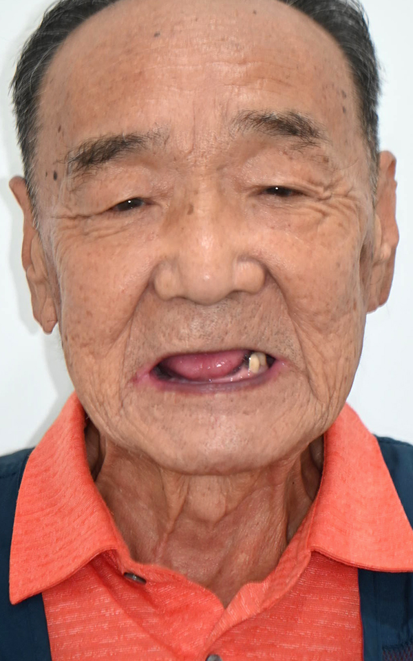 치료 전