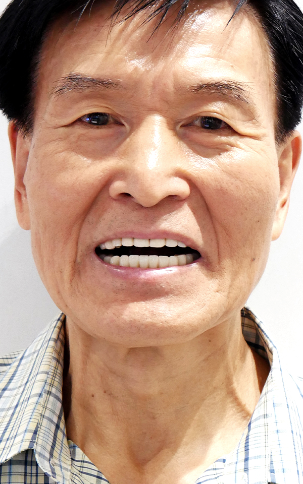 치료 후